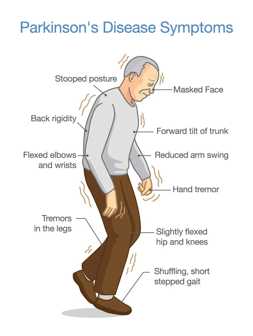 causes-parkinsons