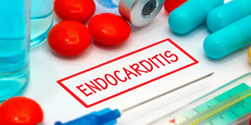 endocarditis-myocarditis